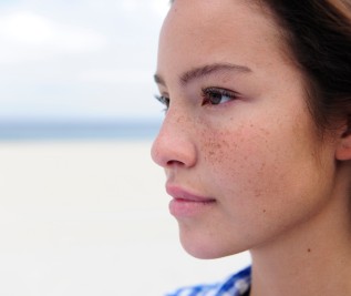 How to Take Care of Freckles and Dark Spots?